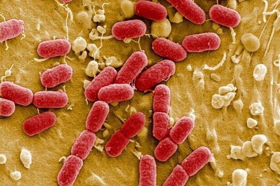 bacterien 20-3-16 (1)