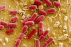 bacterien 20-3-16 (1)