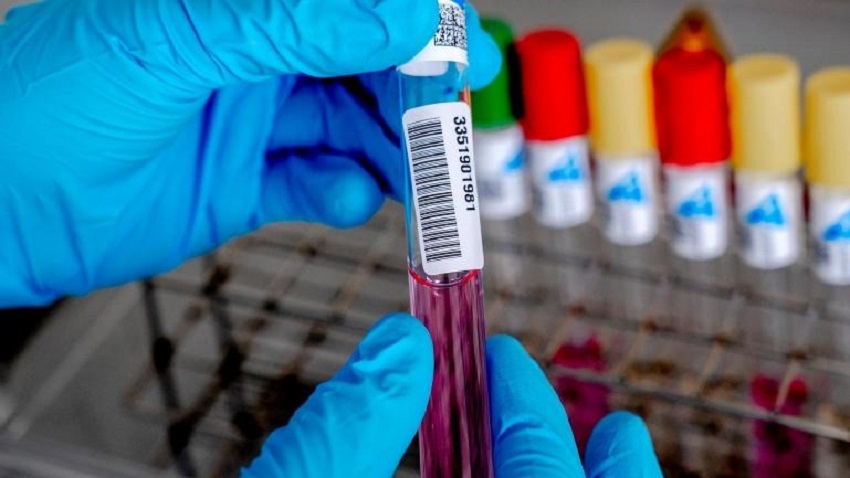 RIVM start onderzoek naar groepsimmuniteit coronavirus