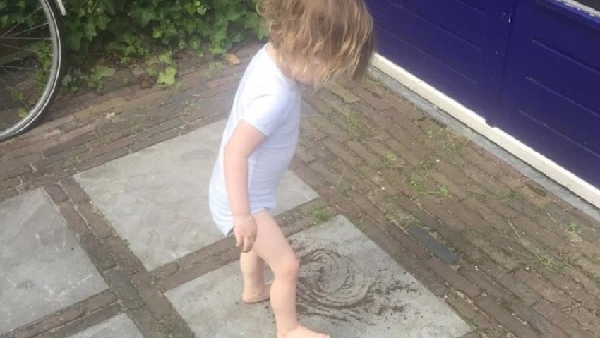 Nederlandse Brandwonden Stichting waarschuwt voor ‘zomerse brandwonden’ bij kinderen